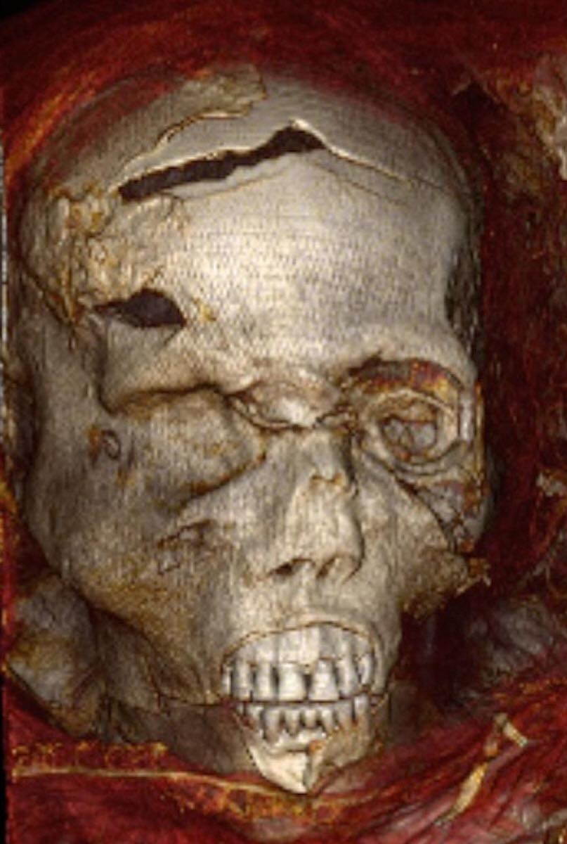 Tomografia em múmia de faraó egípcio revela que ele morreu como um herói - 1